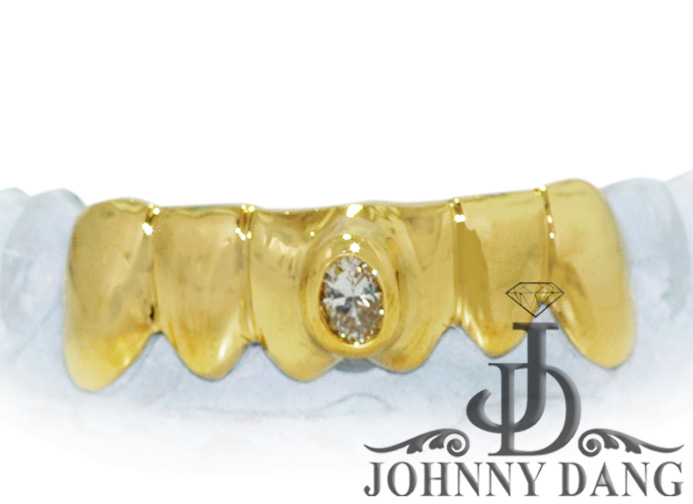 S2530028 6 Solid Gold Teeth With a Single Solitaire