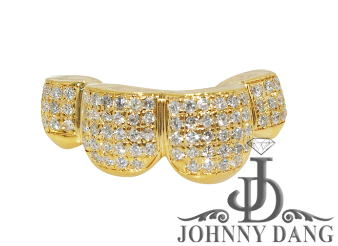 S2530038  4 Solid Gold Teeth with Diamonds