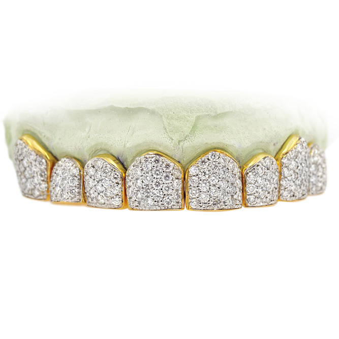 S151505A Eight 18K Individual Diamond Teeth