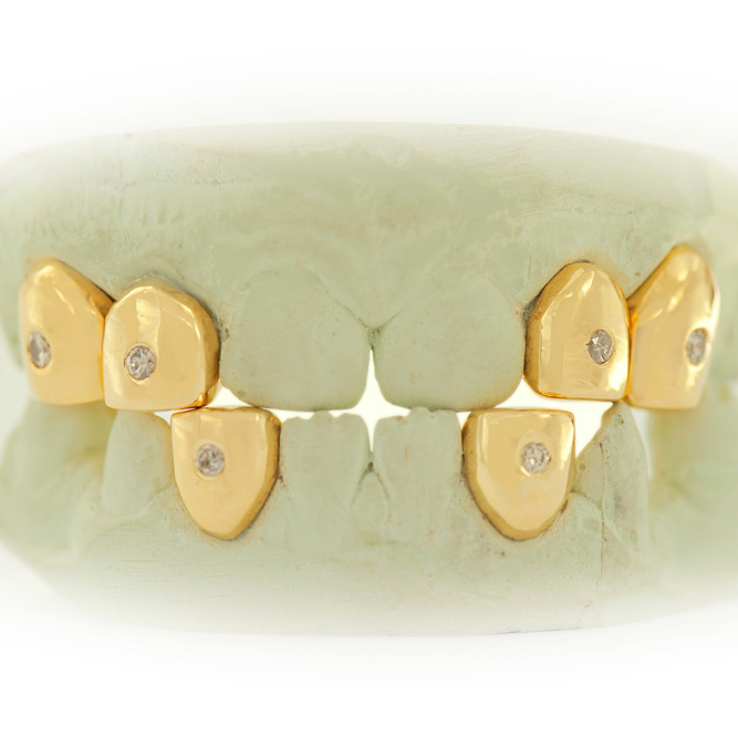 S151608-1 Individual Pave Set Diamond Teeth