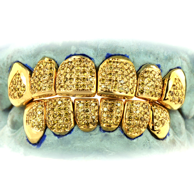 S151706-4 Twelve 18K Individual Hand Prong Set Diamond Teeth